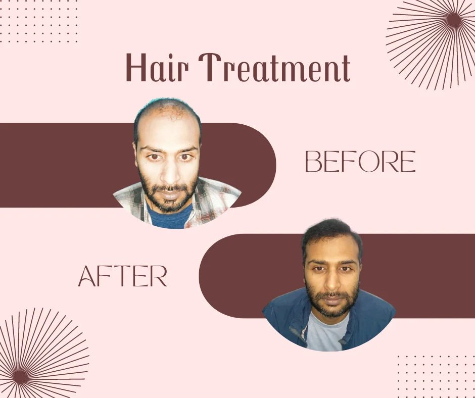Before & After Hair Treatment Look