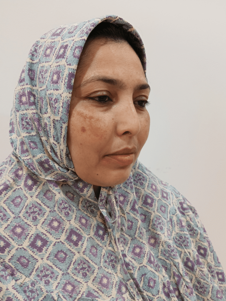 Dark spots and pigmentation before care