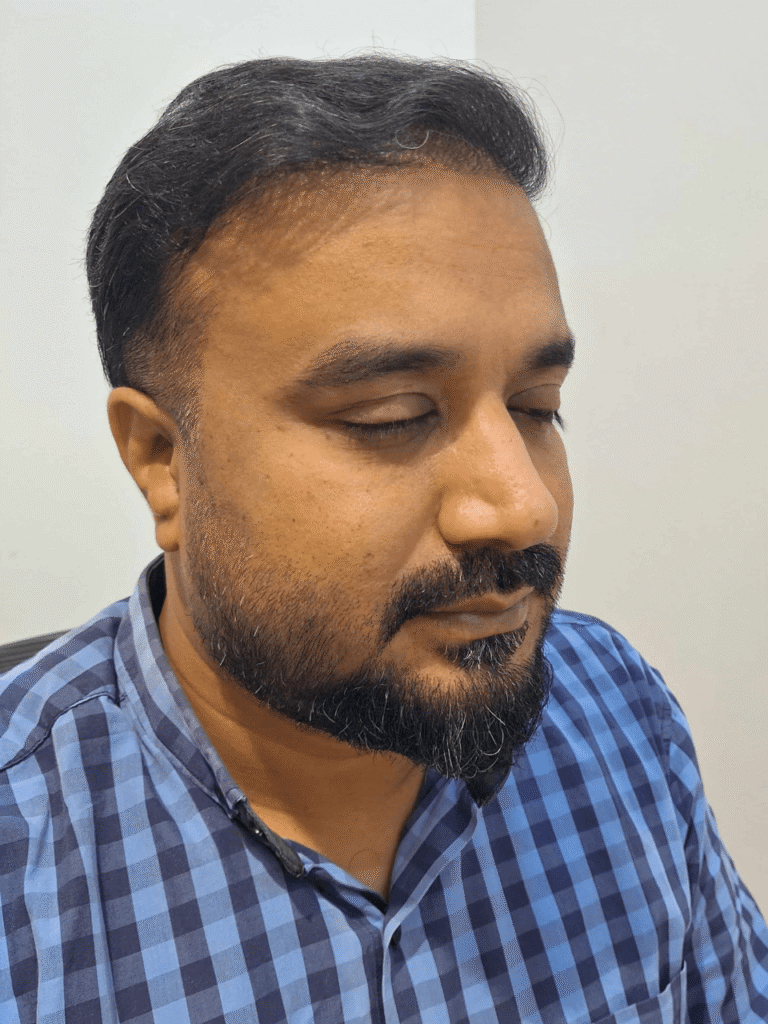 Improved hair volume – after