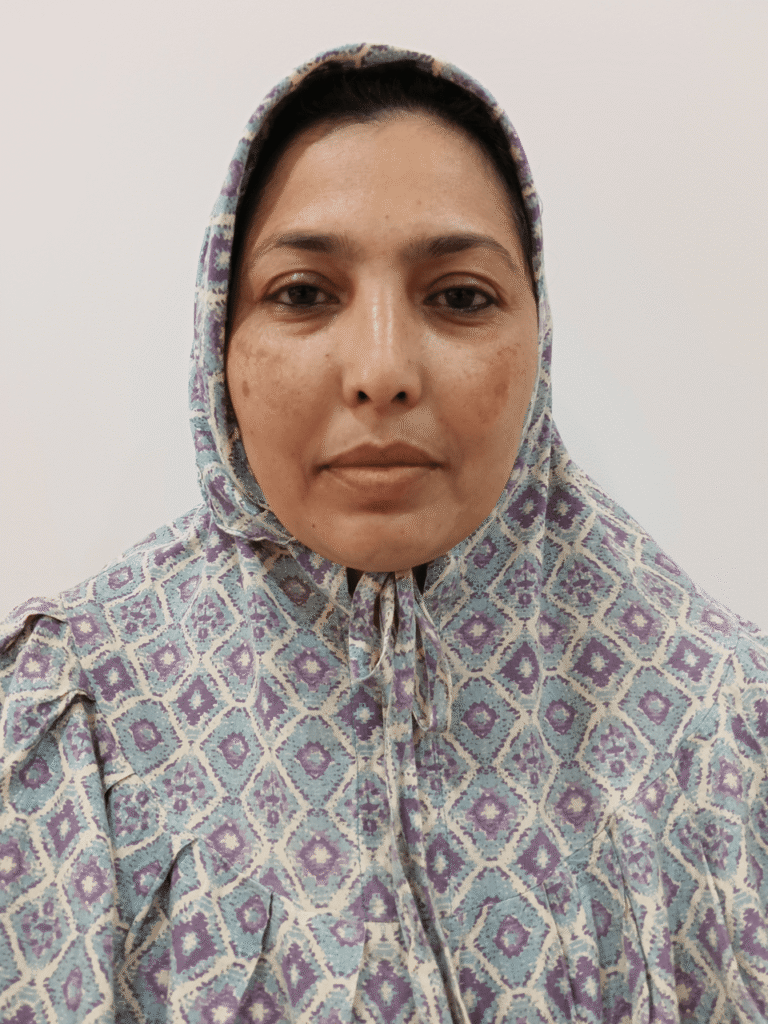 Hyperpigmentation before treatment