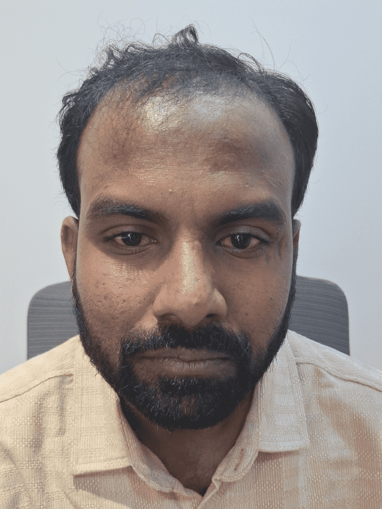 Before image showing fine hair