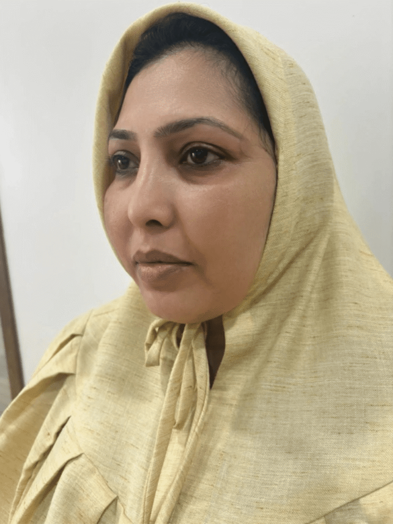 After treatment: clear, even-toned skin