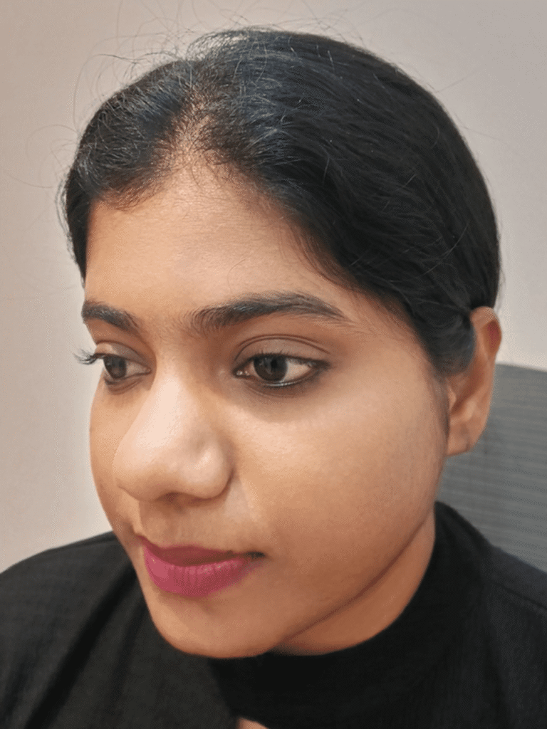 After treatment: clear skin with reduced acne