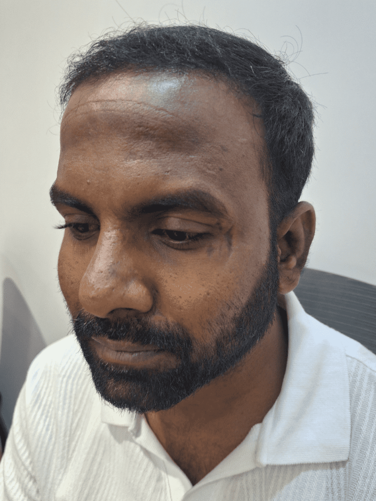 Hair after treatment