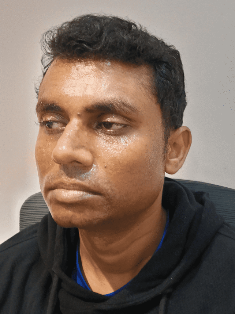 Before Hydrafacial: dull, dehydrated skin